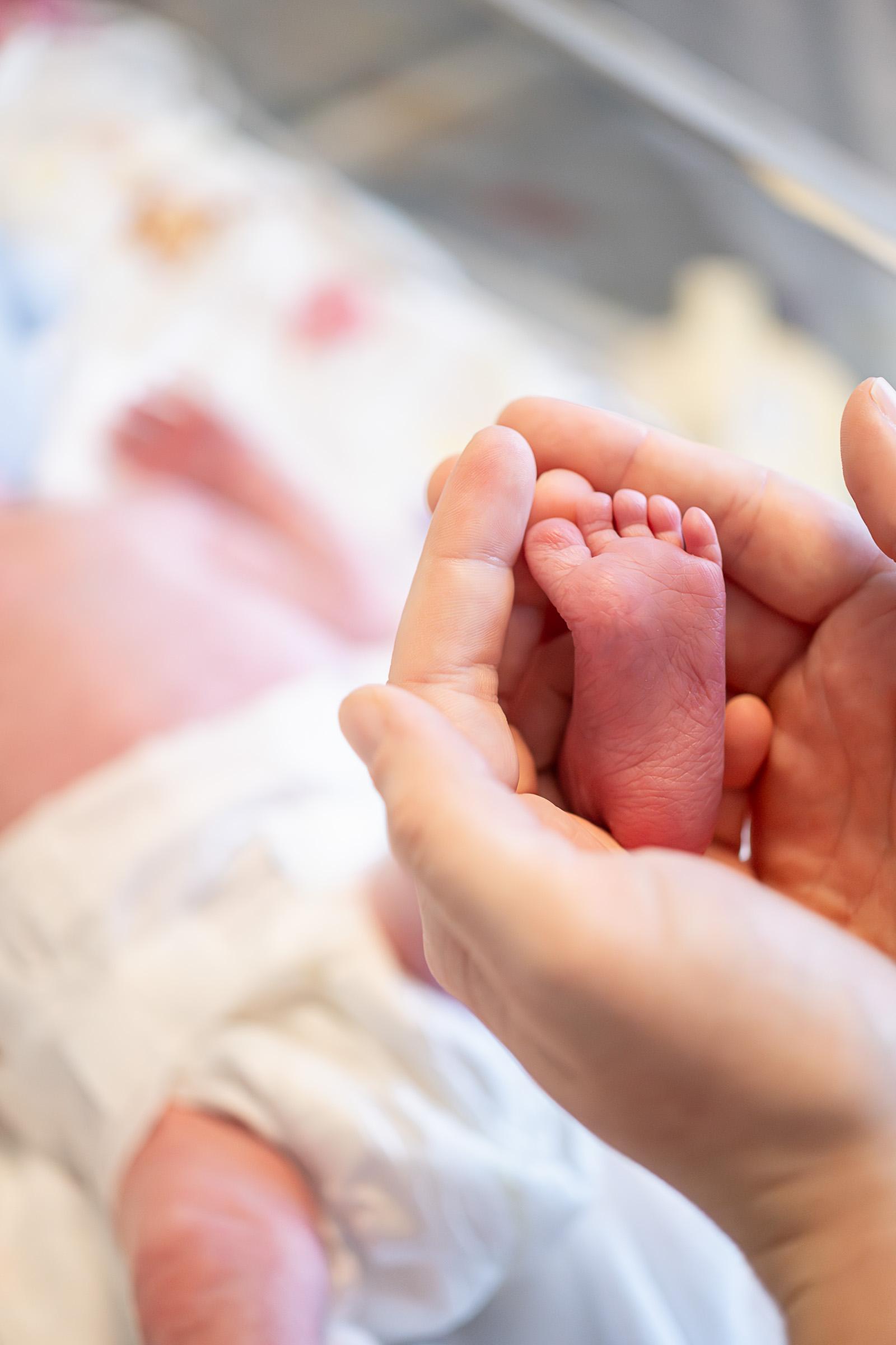 Detalje af fødder på barn født for tidligt under indlæggelse på neonatal