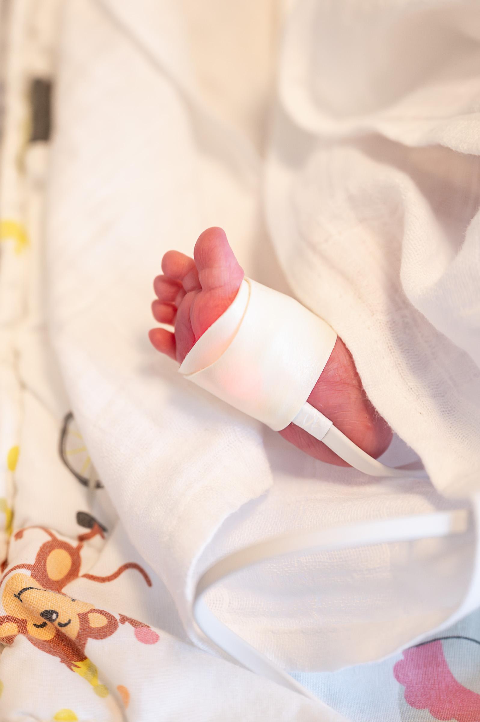 Detalje af foden på barn født for tidligt under indlæggelse på neonatal